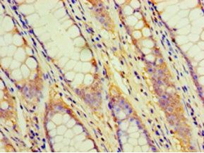 CD2 antibody