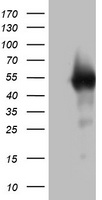 CD20 (MS4A1) antibody