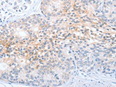 CD200R1 antibody