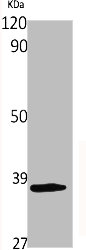 CD200R1 antibody