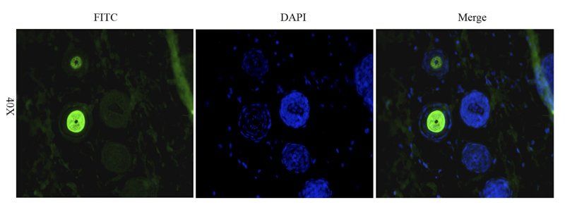 CD206 antibody (FITC)