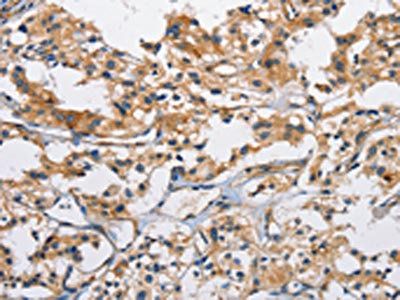 CD207 Antibody