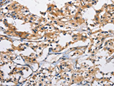 CD207 antibody