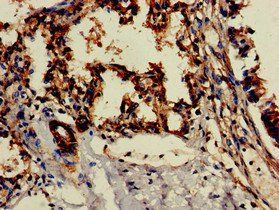 CD209 Antibody