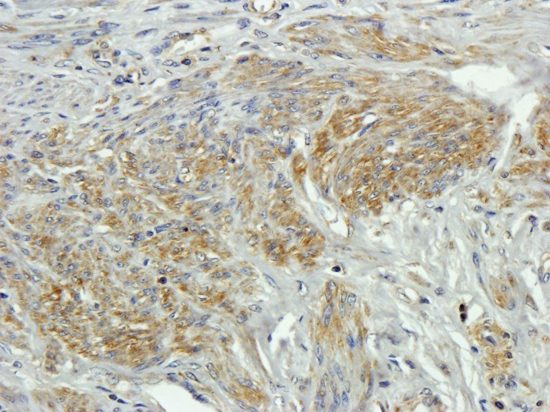 CD20 Rabbit Polyclonal Antibody