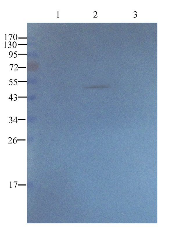 CD20 antibody