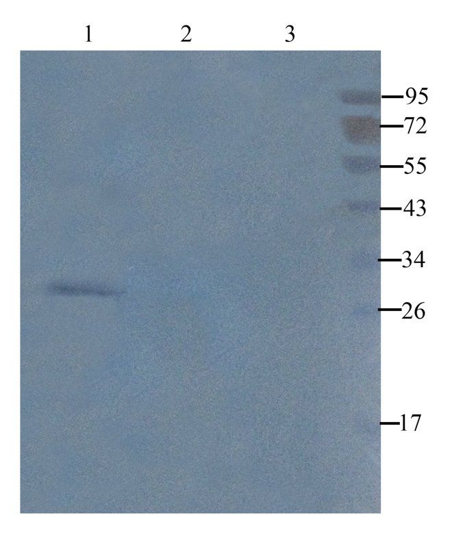 CD20 Rabbit Polyclonal Antibody