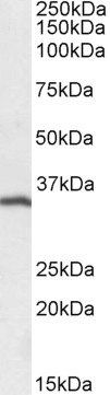 MS4A1 antibody