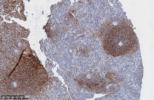 CD21 (CR2) antibody