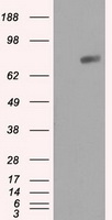 CD21 (CR2) antibody