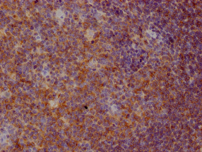 CD22 antibody