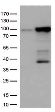 CD229 (LY9) antibody