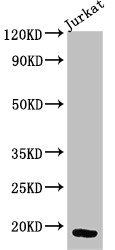 CD247 antibody