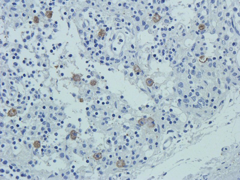 CD24 Rabbit Polyclonal Antibody