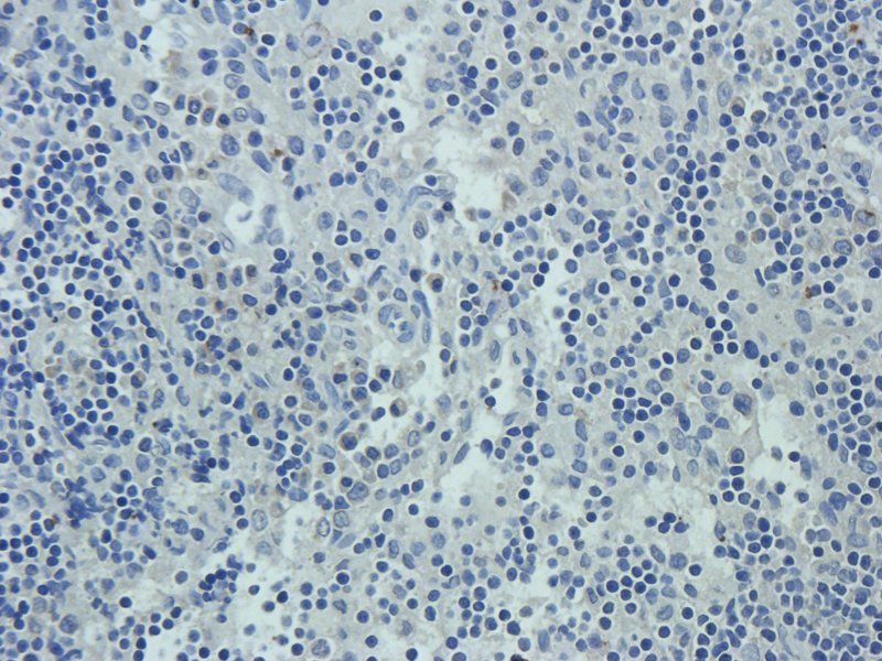 CD24 Rabbit Polyclonal Antibody