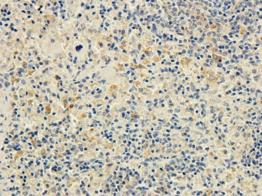 CD25 antibody