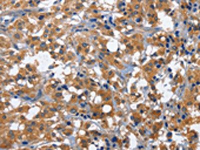 CD27 Antibody