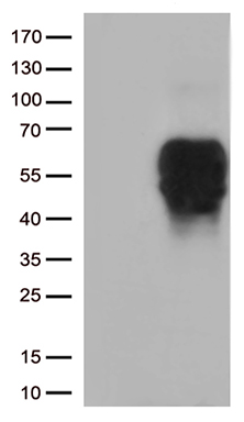 CD272 (BTLA) antibody