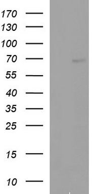 CD272 (BTLA) antibody