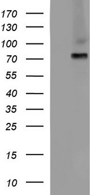 CD272 (BTLA) antibody