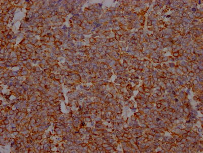 CD274 Recombinant Monoclonal Antibody