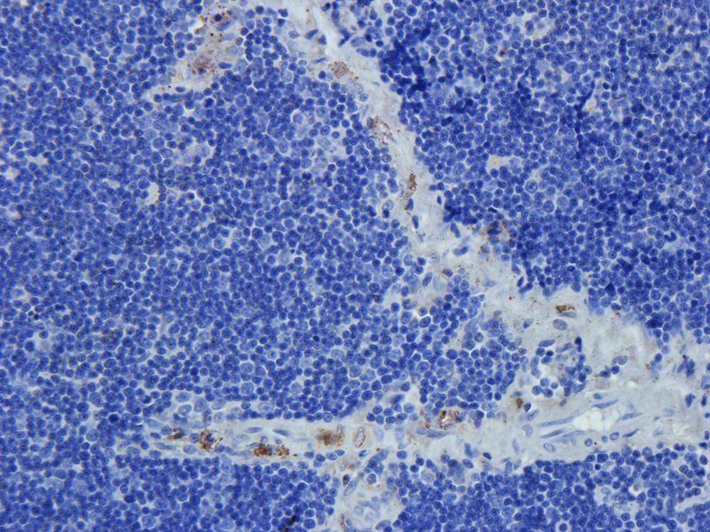 CD274 Rabbit Polyclonal Antibody