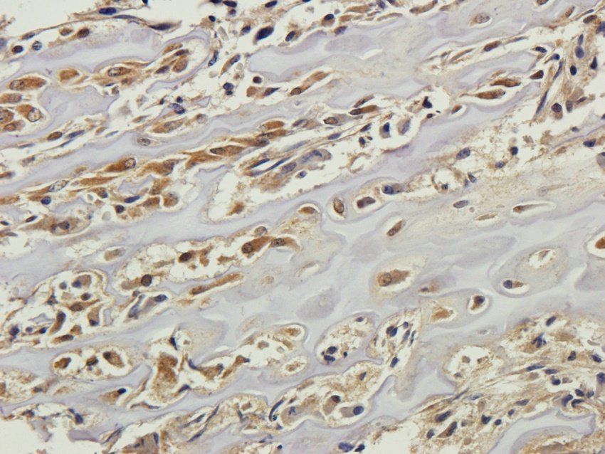 CD28 antibody