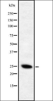 CD28 (Phospho-Tyr218) antibody