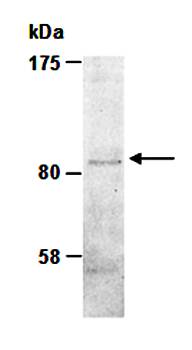 Integrin beta 1 antibody