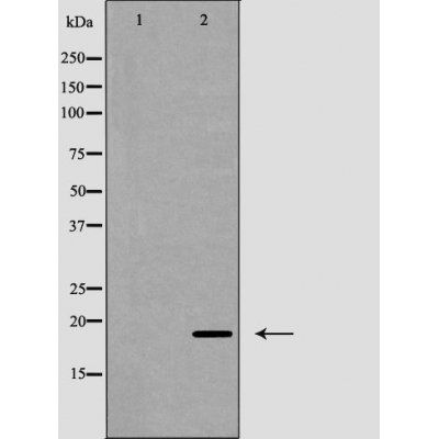 CD3 Zeta (Phospho-Tyr142) antibody