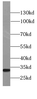 CD301 antibody
