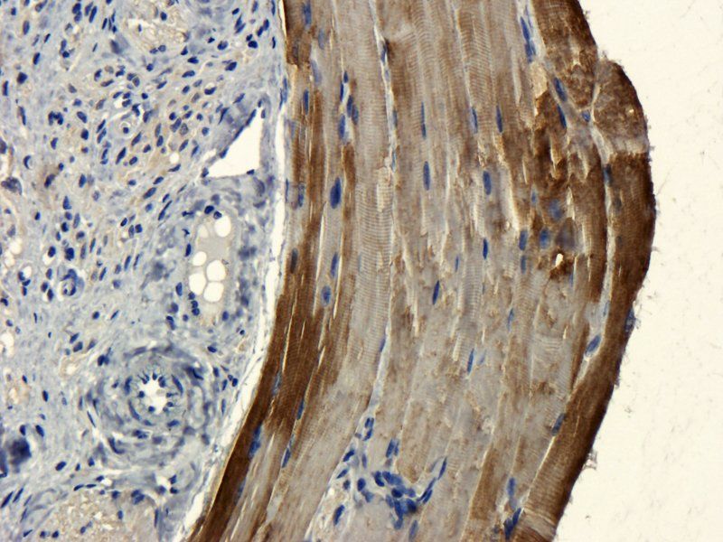 CD303 Rabbit Polyclonal Antibody