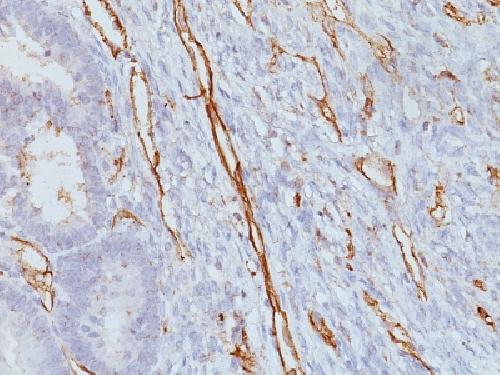 CD31 / PECAM-1 (Endothelial Cell Marker) Antibody