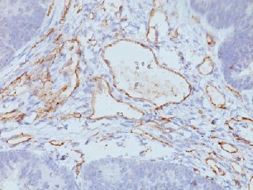 CD31 / PECAM-1 (Endothelial Cell Marker) Antibody