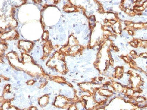 Recombinant CD31 / PECAM-1 (Endothelial Cell Marker) Antibody