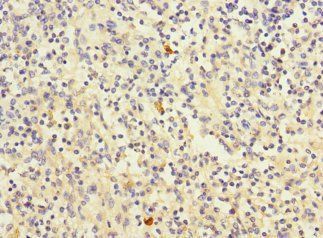 CD320 Antibody