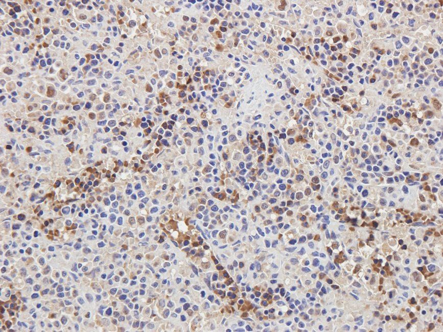 CD32b antibody