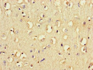 FCGR2B Antibody