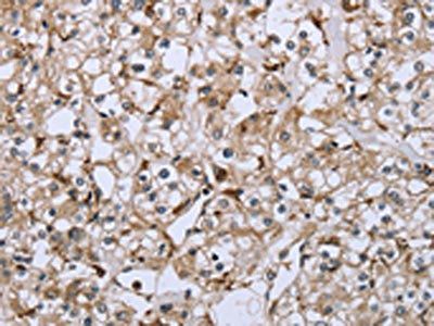 FCGR2B Antibody