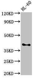 CD33 antibody