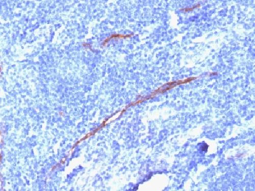 Recombinant CD34 (Hematopoietic Stem Cell & Endothelial Marker) Antibody