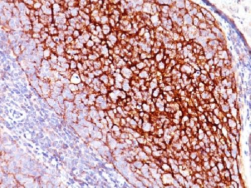 CD35 / CR1 (Follicular Dendritic Cell Marker) Antibody