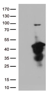 CD35 (CR1) antibody