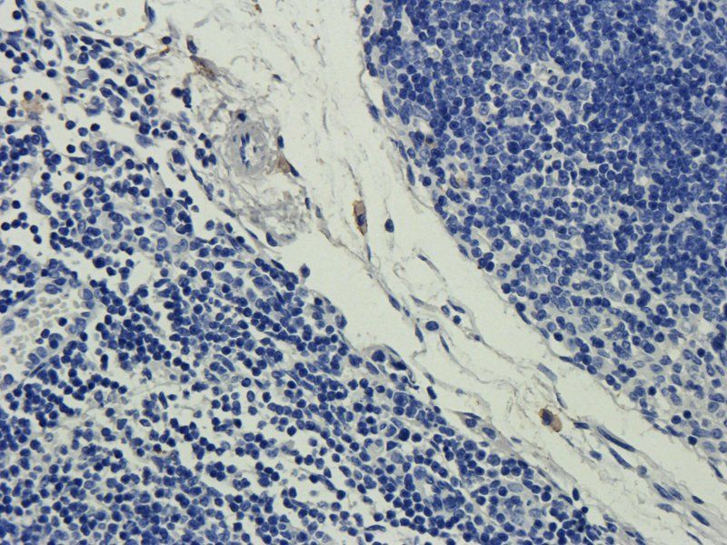CD35 Rabbit Polyclonal Antibody
