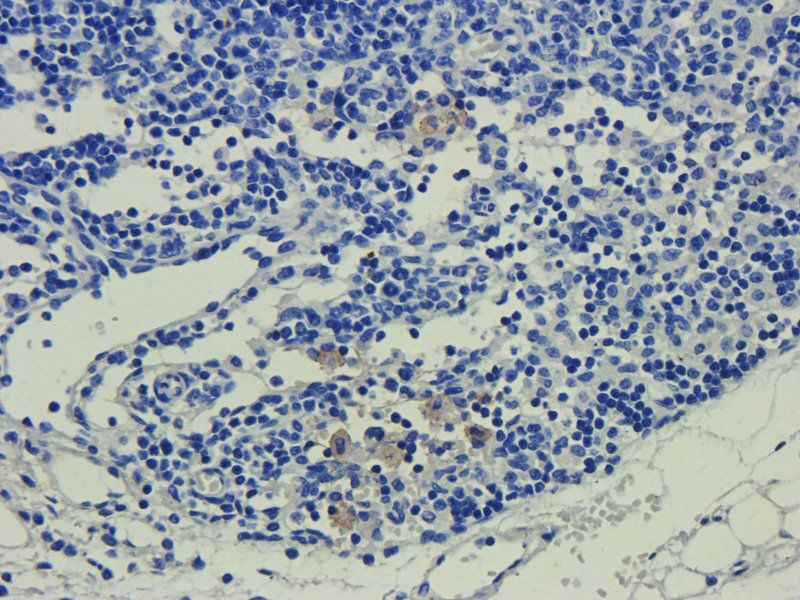 CD35 Rabbit Polyclonal Antibody
