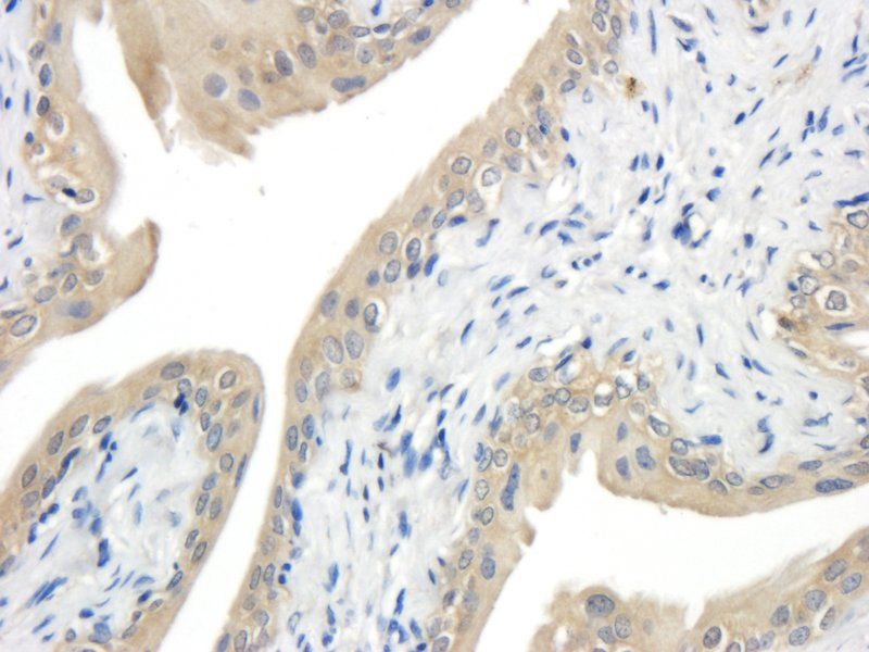 CD35 Rabbit Polyclonal Antibody