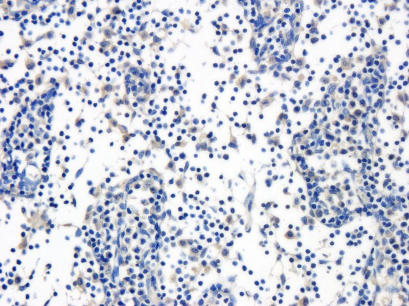 CD35 antibody