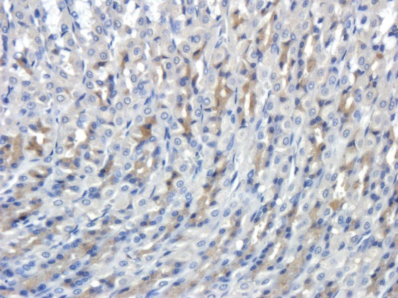 CD35 Rabbit Polyclonal Antibody