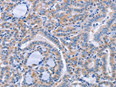 CD36 Antibody