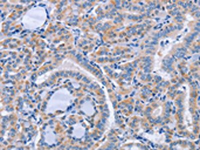 CD36 antibody